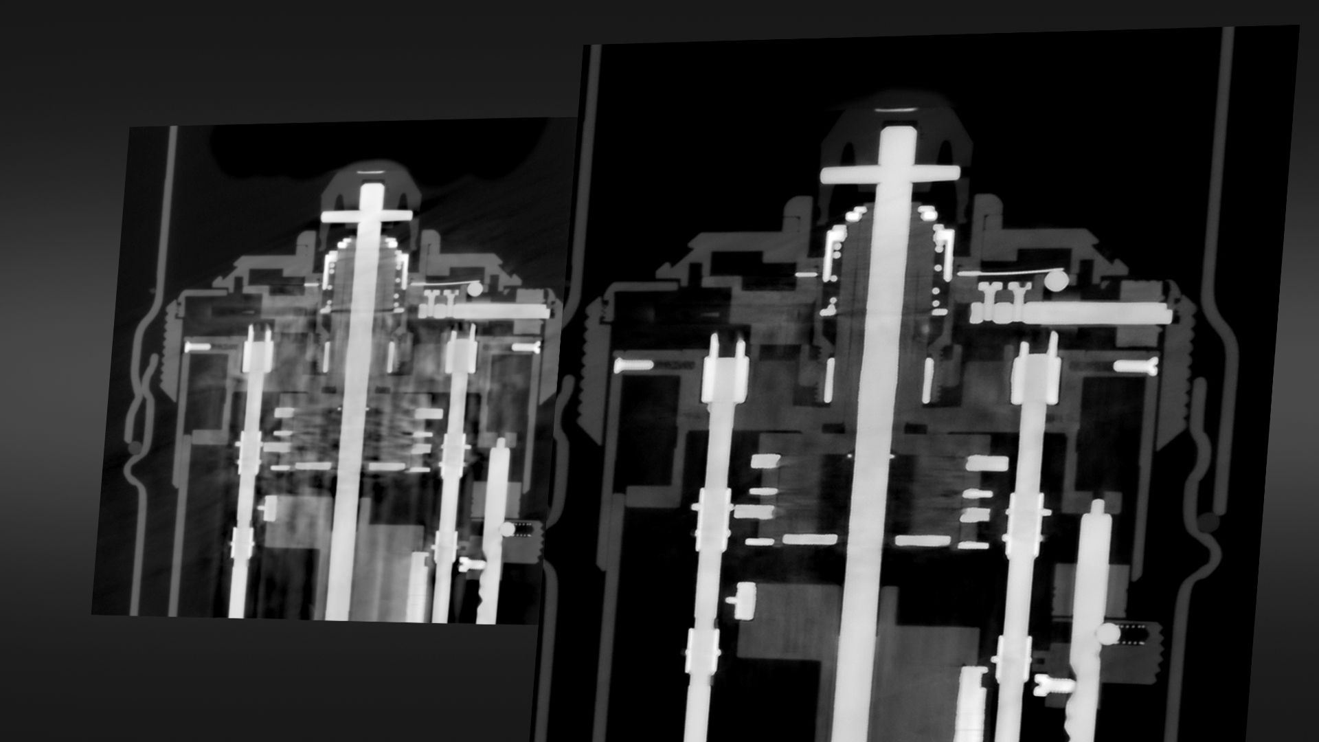 การลดอาร์ติแฟกต์จากวัสดุผสมขั้นสูง (AMMAR)