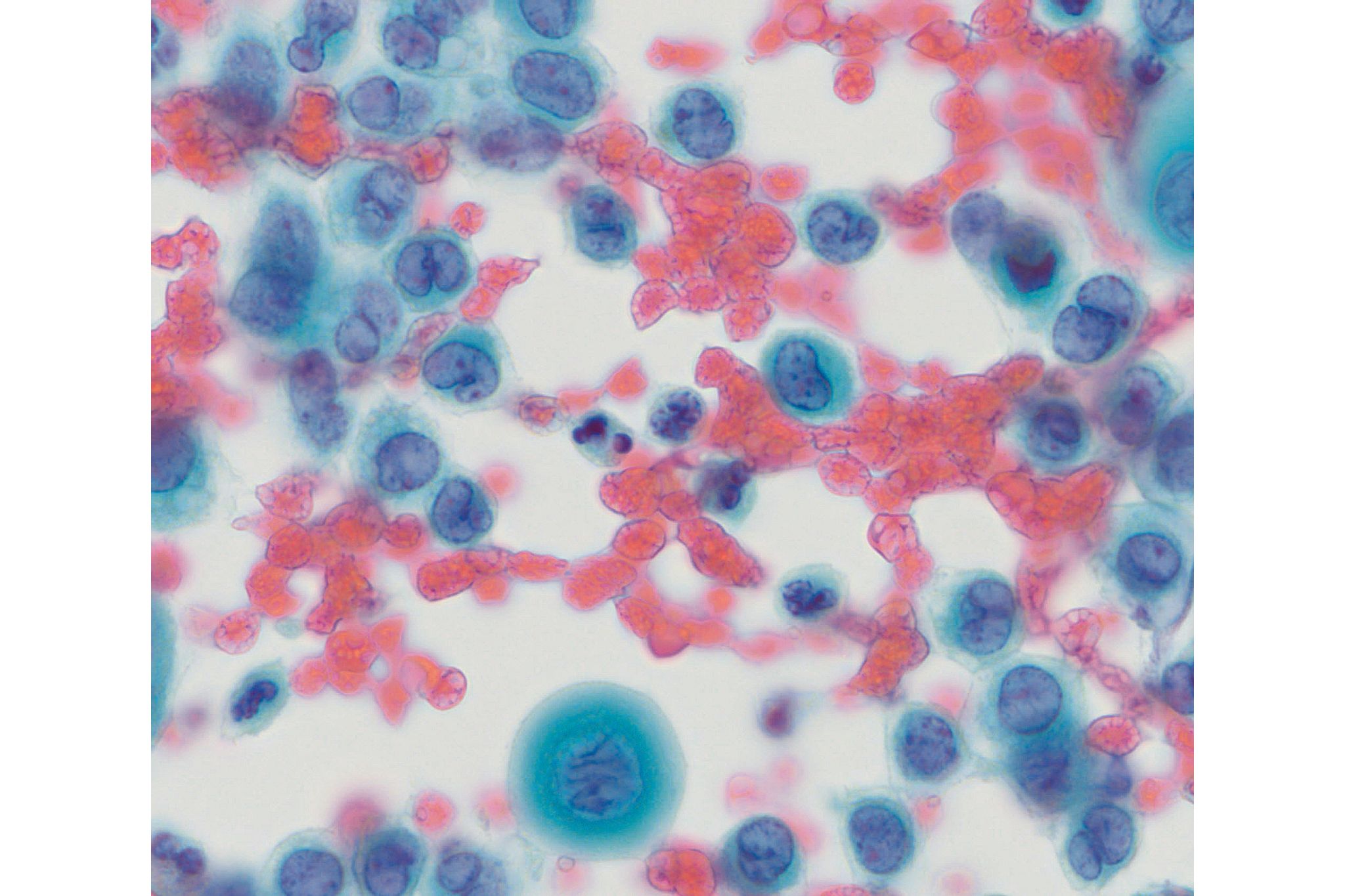 Cytology Bundle Download